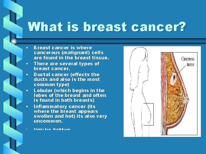 What is breast cancer? • • • Breast cancer is where cancerous (malignant) cells