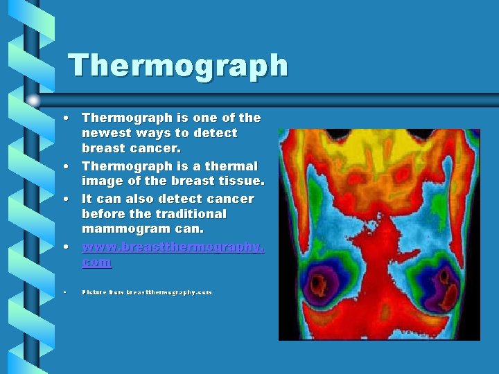 Thermograph • Thermograph is one of the newest ways to detect breast cancer. •