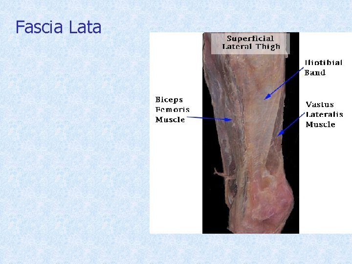 Fascia Lata 