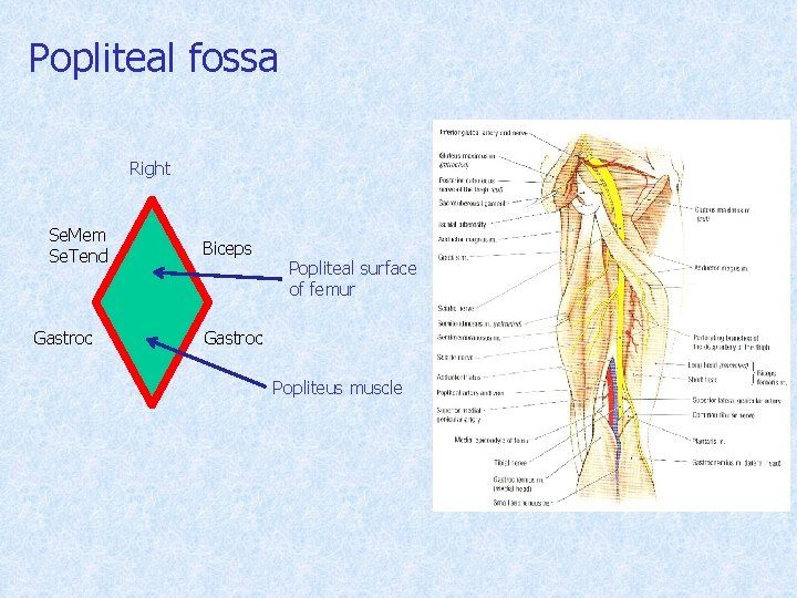 Popliteal fossa Right Se. Mem Se. Tend Gastroc Biceps Popliteal surface of femur Gastroc