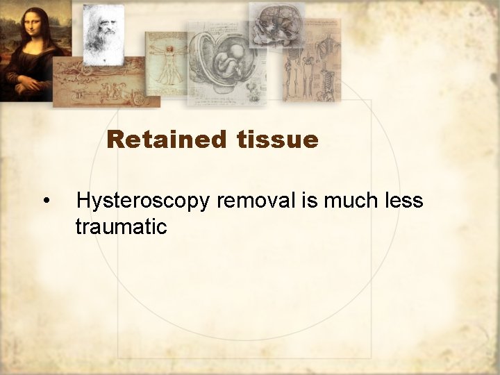 Retained tissue • Hysteroscopy removal is much less traumatic 
