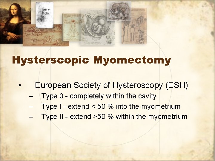 Hysterscopic Myomectomy • European Society of Hysteroscopy (ESH) – – – Type 0 -