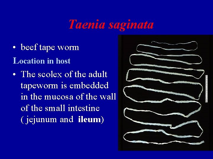 Taenia saginata • beef tape worm Location in host • The scolex of the