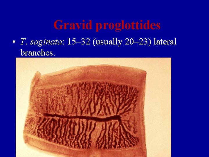 Gravid proglottides • T. saginata: 15– 32 (usually 20– 23) lateral branches. 