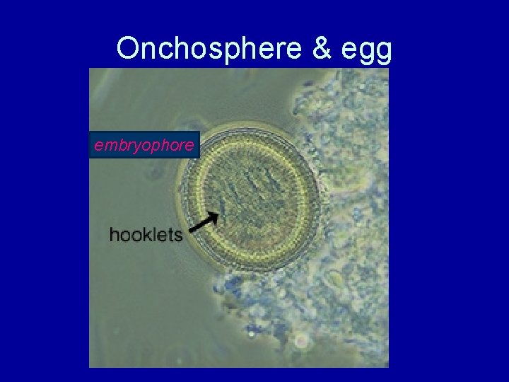 Onchosphere & egg embryophore 