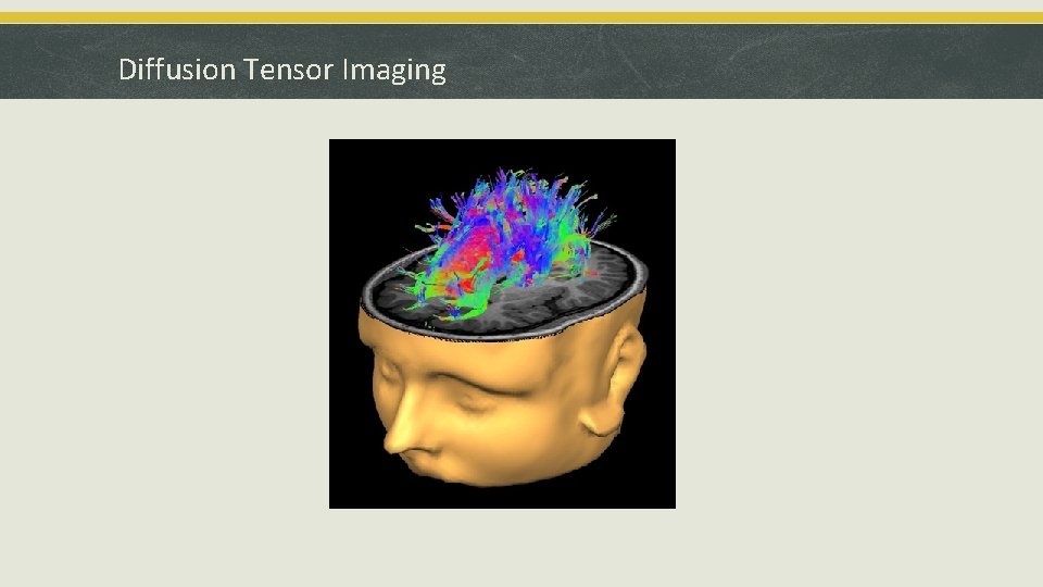 Diffusion Tensor Imaging 