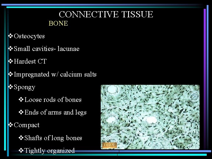 CONNECTIVE TISSUE BONE v. Osteocytes v. Small cavities- lacunae v. Hardest CT v. Impregnated