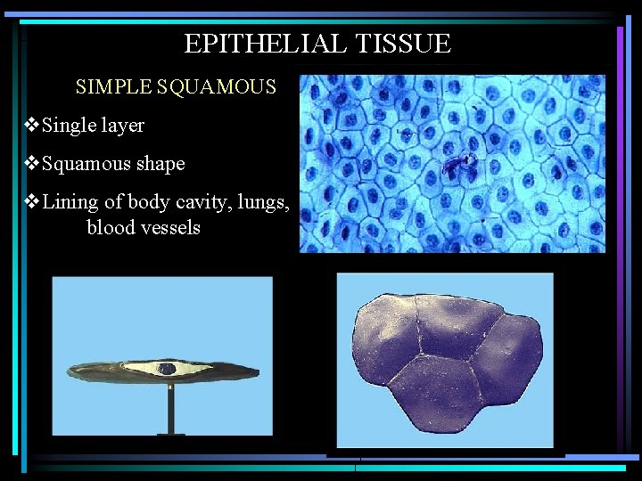 EPITHELIAL TISSUE SIMPLE SQUAMOUS v. Single layer v. Squamous shape v. Lining of body