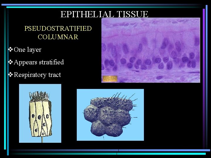 EPITHELIAL TISSUE PSEUDOSTRATIFIED COLUMNAR v. One layer v. Appears stratified v. Respiratory tract 
