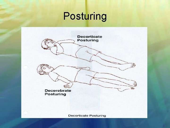 Posturing 