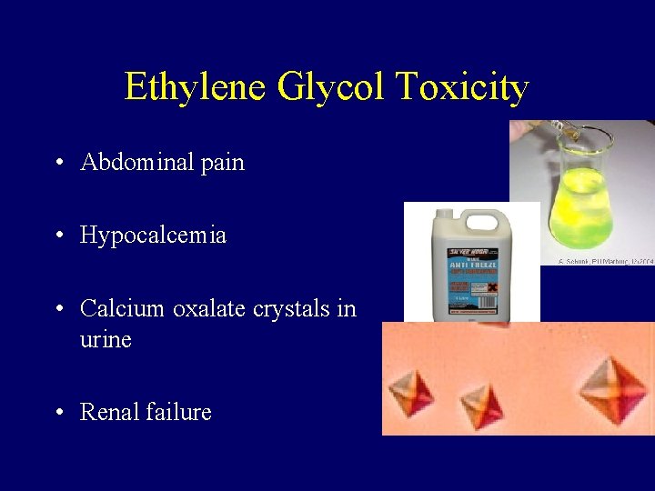 Ethylene Glycol Toxicity • Abdominal pain • Hypocalcemia • Calcium oxalate crystals in urine