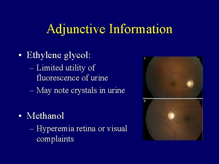 Adjunctive Information • Ethylene glycol: – Limited utility of fluorescence of urine – May