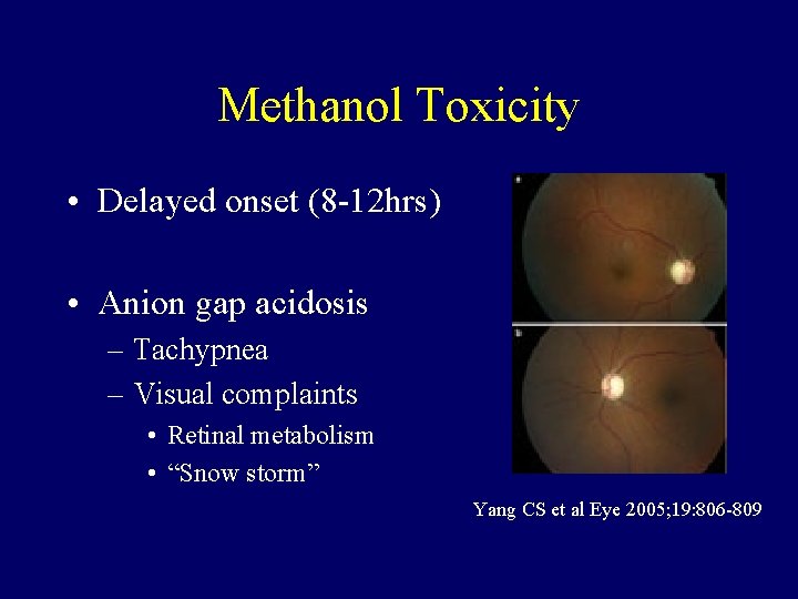 Methanol Toxicity • Delayed onset (8 -12 hrs) • Anion gap acidosis – Tachypnea