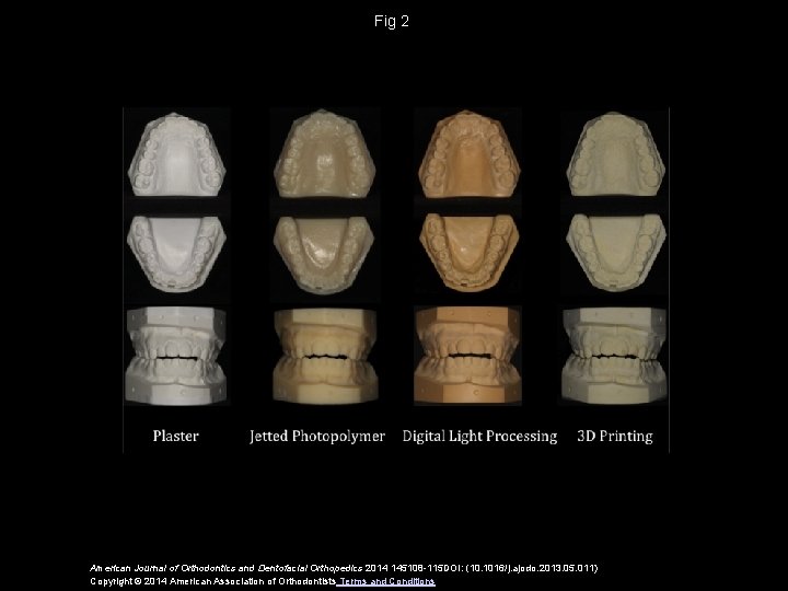 Fig 2 American Journal of Orthodontics and Dentofacial Orthopedics 2014 145108 -115 DOI: (10.