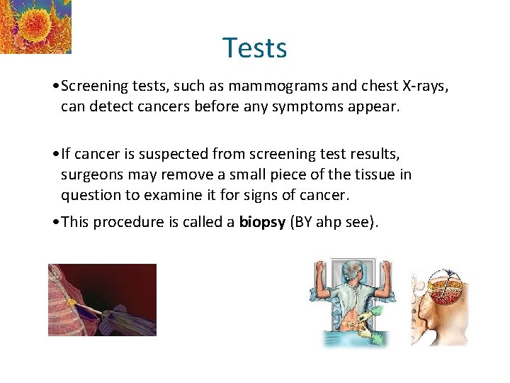 Tests • Screening tests, such as mammograms and chest X-rays, can detect cancers before