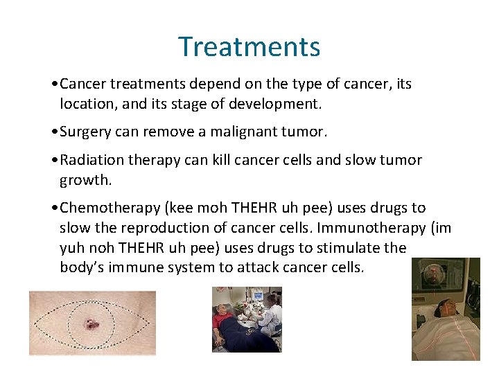 Treatments • Cancer treatments depend on the type of cancer, its location, and its