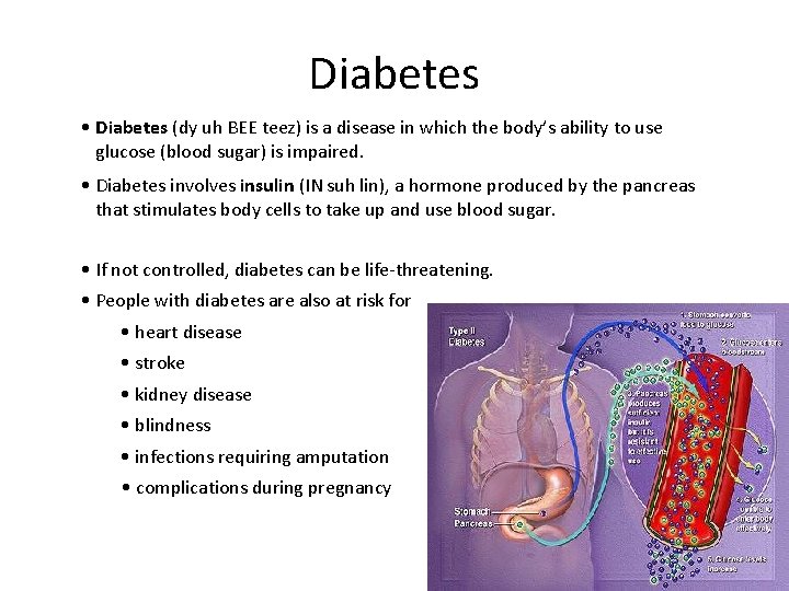 Diabetes • Diabetes (dy uh BEE teez) is a disease in which the body’s