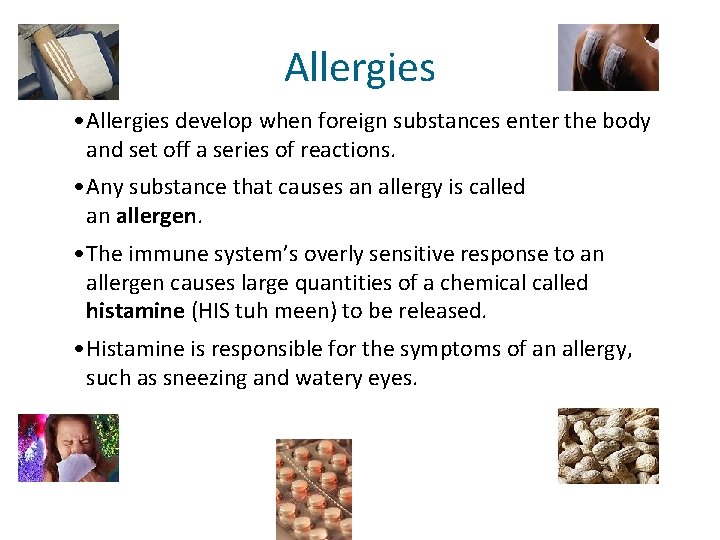 Allergies • Allergies develop when foreign substances enter the body and set off a