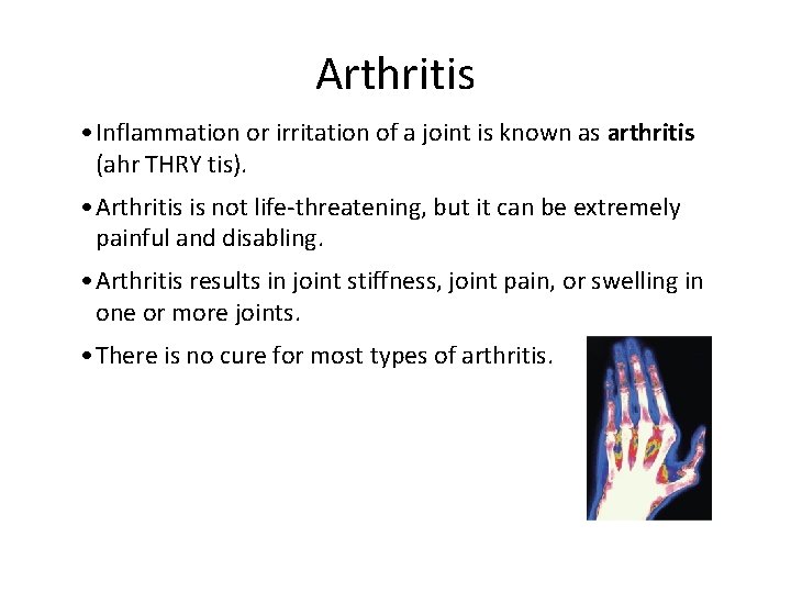 Arthritis • Inflammation or irritation of a joint is known as arthritis (ahr THRY