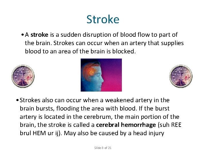 Stroke • A stroke is a sudden disruption of blood flow to part of