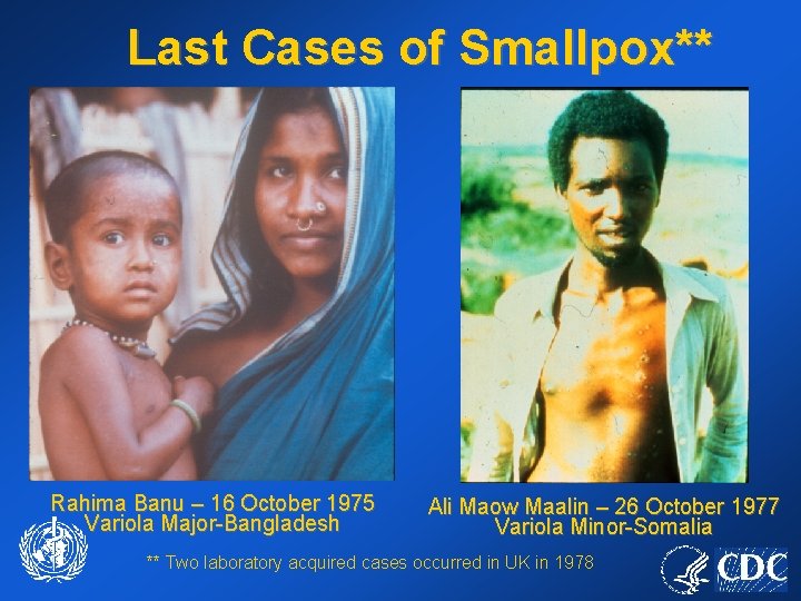 Last Cases of Smallpox** Rahima Banu – 16 October 1975 Variola Major-Bangladesh Ali Maow