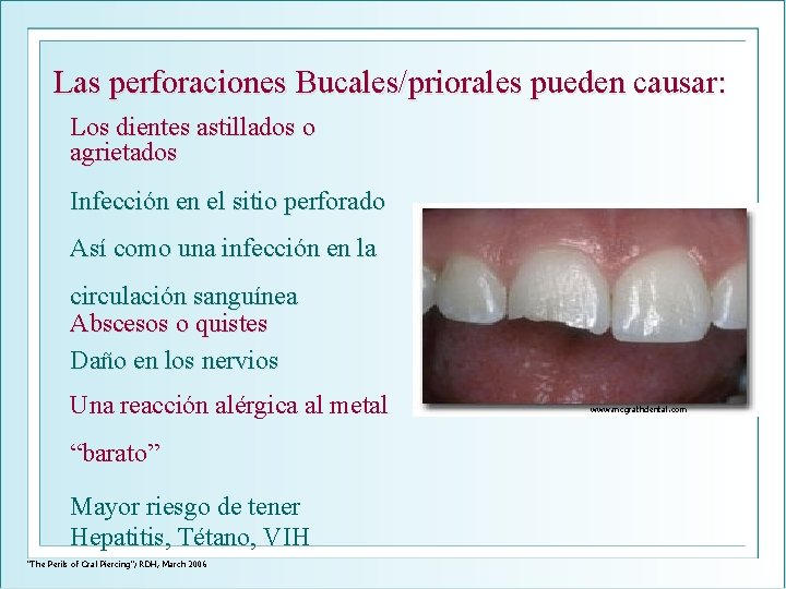 Las perforaciones Bucales/priorales pueden causar: Los dientes astillados o agrietados Infección en el sitio