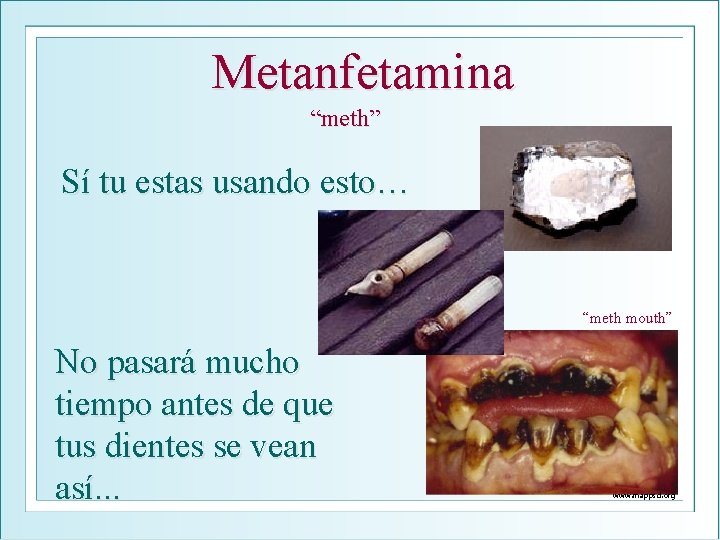 Metanfetamina “meth” Sí tu estas usando esto… “meth mouth” No pasará mucho tiempo antes