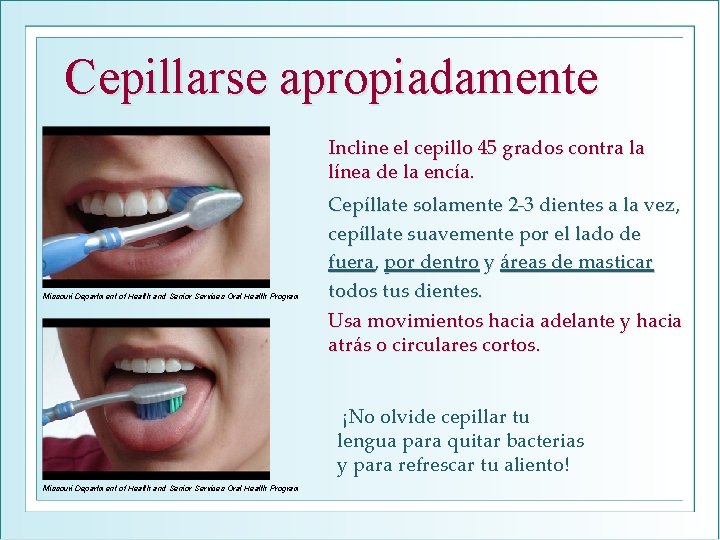 Cepillarse apropiadamente Incline el cepillo 45 grados contra la línea de la encía. Missouri