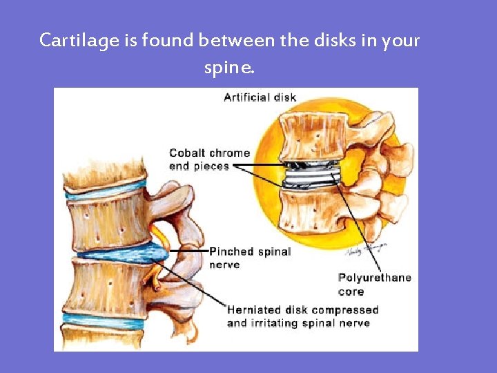 Cartilage is found between the disks in your spine. 