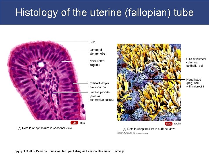 Histology of the uterine (fallopian) tube Copyright © 2009 Pearson Education, Inc. , publishing