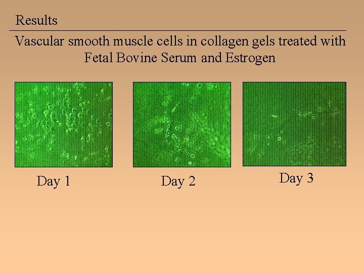 Results Vascular smooth muscle cells in collagen gels treated with Fetal Bovine Serum and