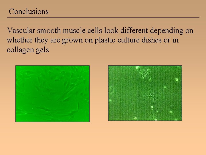 Conclusions Vascular smooth muscle cells look different depending on whether they are grown on