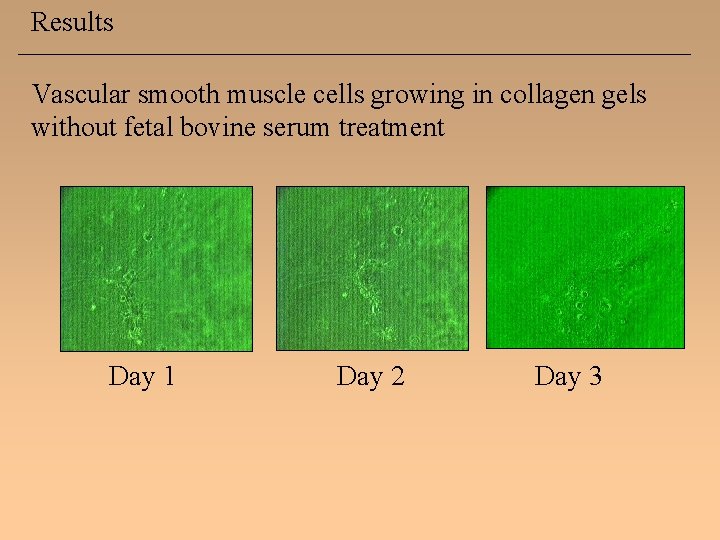 Results Vascular smooth muscle cells growing in collagen gels without fetal bovine serum treatment