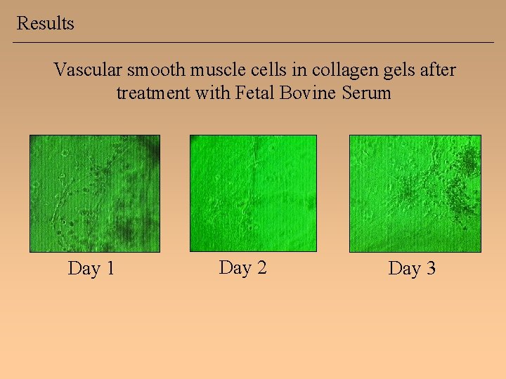 Results Vascular smooth muscle cells in collagen gels after treatment with Fetal Bovine Serum