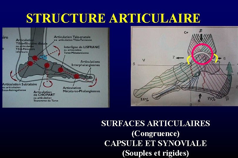 STRUCTURE ARTICULAIRE SURFACES ARTICULAIRES (Congruence) CAPSULE ET SYNOVIALE (Souples et rigides) 