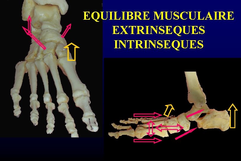 EQUILIBRE MUSCULAIRE EXTRINSEQUES INTRINSEQUES 