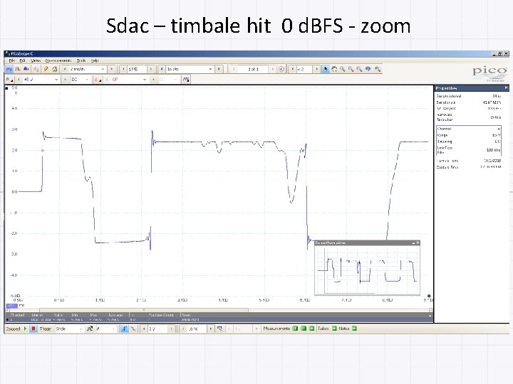 Sdac – timbale hit 0 d. BFS - zoom 