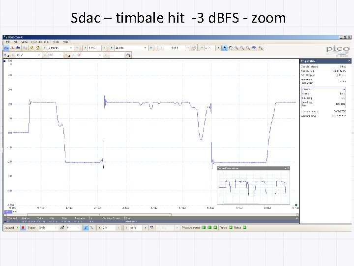 Sdac – timbale hit -3 d. BFS - zoom 