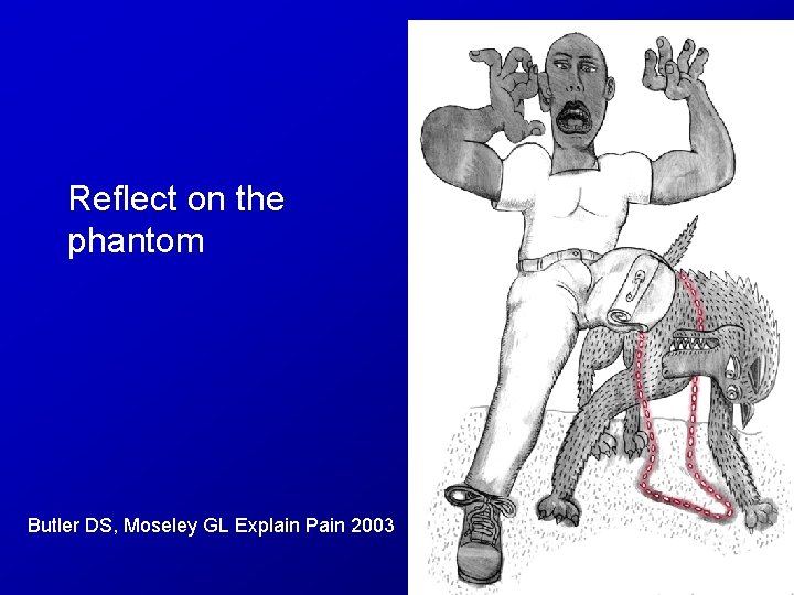 Reflect on the phantom Butler DS, Moseley GL Explain Pain 2003 