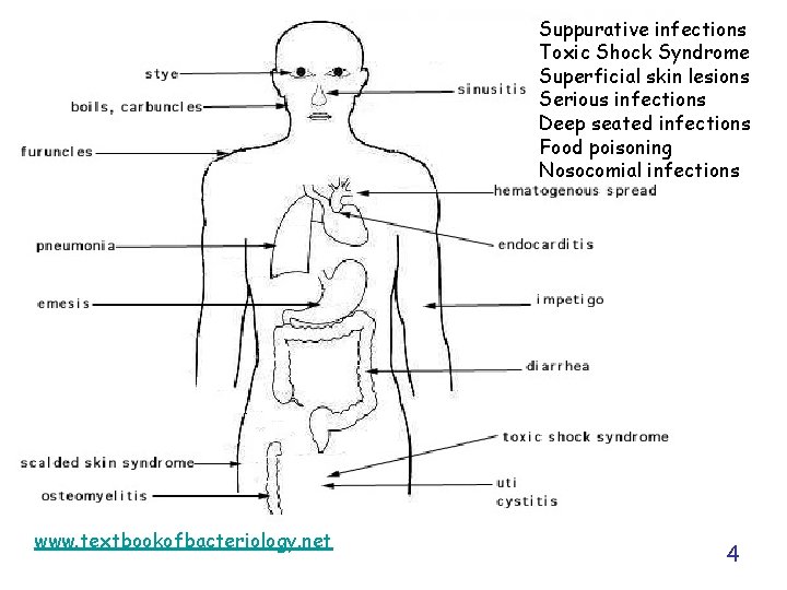 Suppurative infections Toxic Shock Syndrome Superficial skin lesions Serious infections Deep seated infections Food