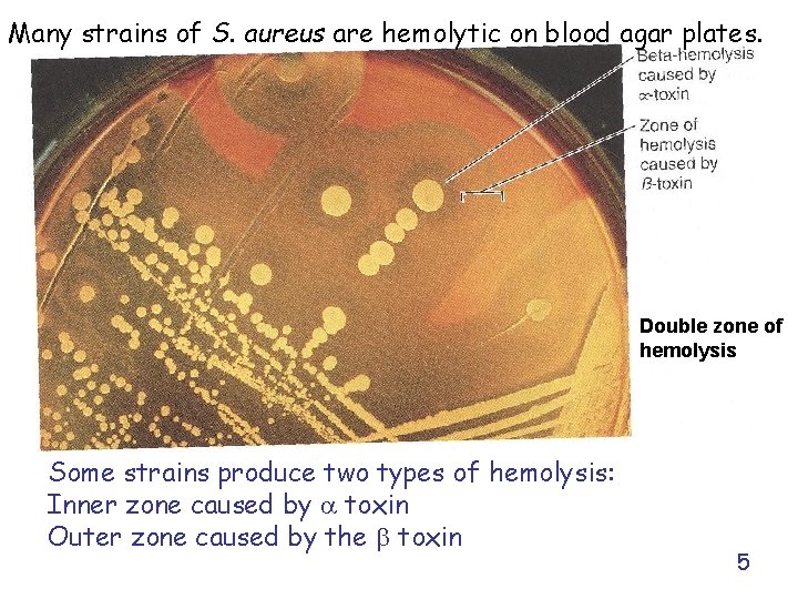 Many strains of S. aureus are hemolytic on blood agar plates. Double zone of