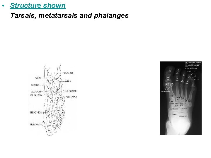  • Structure shown Tarsals, metatarsals and phalanges 