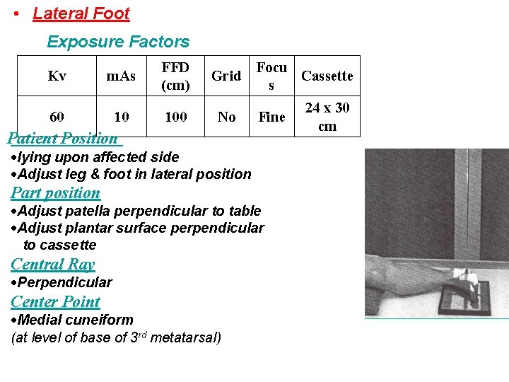  • Lateral Foot Exposure Factors Kv m. As 60 10 FFD (cm) 100