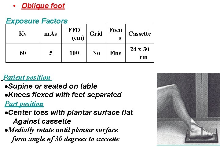  • Oblique foot Exposure Factors Kv 60 m. As 5 FFD Focu Grid