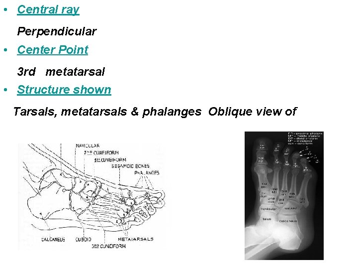  • Central ray Perpendicular • Center Point 3 rd metatarsal • Structure shown