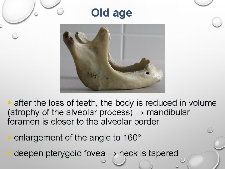 Old age § after the loss of teeth, the body is reduced in volume
