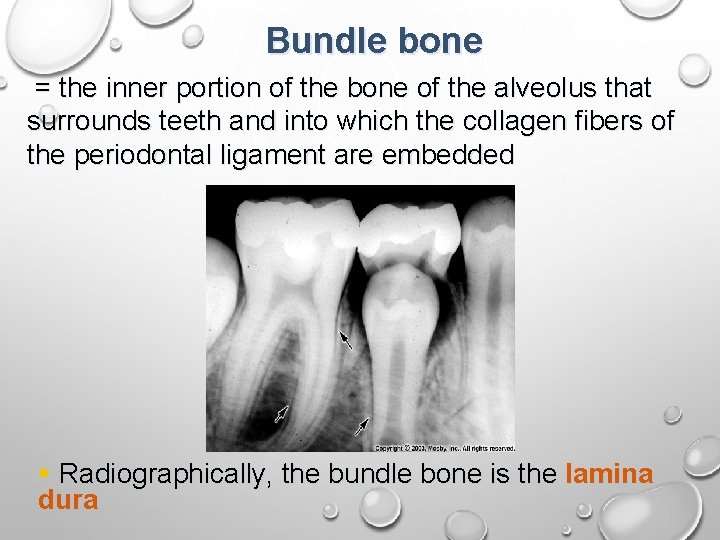 Bundle bone = the inner portion of the bone of the alveolus that surrounds