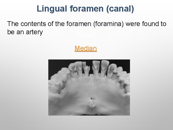 Lingual foramen (canal) The contents of the foramen (foramina) were found to be an Lingual foramen (canal) The contents of the foramen (foramina) were found to be an