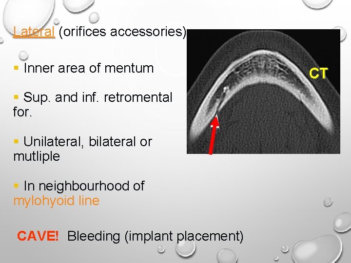 Lateral (orifices accessories) § Inner area of mentum § Sup. and inf. retromental for. Lateral (orifices accessories) § Inner area of mentum § Sup. and inf. retromental for.
