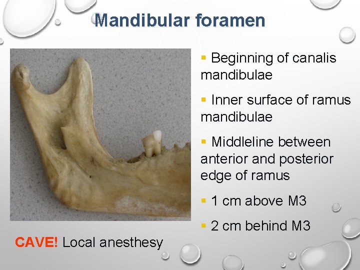 Mandibular foramen § Beginning of canalis mandibulae § Inner surface of ramus mandibulae §